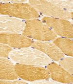 ENT2 Antibody in Immunohistochemistry (Paraffin) (IHC (P))