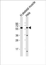 ENT2 Antibody in Western Blot (WB)