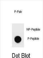 Phospho-MYH9 (Tyr158) Antibody in Dot Blot (DB)