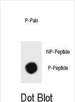 Phospho-TSC1 (Ser312) Antibody in Dot Blot (DB)