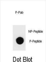 Phospho-TSC1 (Thr417) Antibody in Dot Blot (DB)