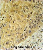 WNT5A Antibody in Immunohistochemistry (Paraffin) (IHC (P))