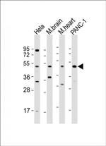 WNT5A Antibody in Western Blot (WB)