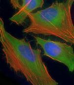 ASS1 Antibody in Immunocytochemistry (ICC/IF)