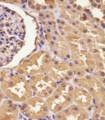 ASS1 Antibody in Immunohistochemistry (Paraffin) (IHC (P))