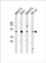 ASS1 Antibody in Western Blot (WB)