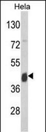 ASS1 Antibody in Western Blot (WB)