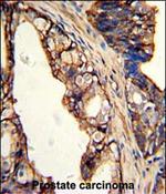 TGM4 Antibody in Immunohistochemistry (Paraffin) (IHC (P))