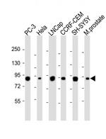 TGM4 Antibody in Western Blot (WB)