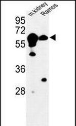 CBS Antibody in Western Blot (WB)