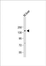 BCOR Antibody in Western Blot (WB)