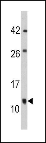 FKBP1B Antibody in Western Blot (WB)