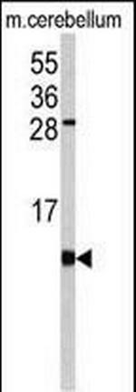 FKBP1B Antibody in Western Blot (WB)