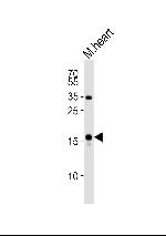 ANP Antibody in Western Blot (WB)