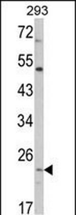 ATP Synthase O Antibody in Western Blot (WB)