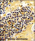 NKG2A Antibody in Immunohistochemistry (Paraffin) (IHC (P))