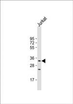 NKG2A Antibody in Western Blot (WB)