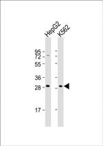 NKG2A Antibody in Western Blot (WB)