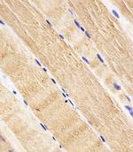 RAB7A Antibody in Immunohistochemistry (Paraffin) (IHC (P))