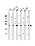 RAB7A Antibody in Western Blot (WB)