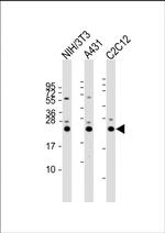 RAB7A Antibody in Western Blot (WB)