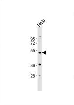 PXR Antibody in Western Blot (WB)