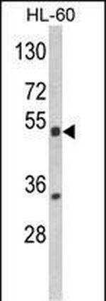 PXR Antibody in Western Blot (WB)