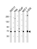 GBA Antibody in Western Blot (WB)