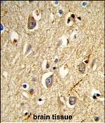 RAB8A Antibody in Immunohistochemistry (Paraffin) (IHC (P))