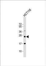 RAB8A Antibody in Western Blot (WB)