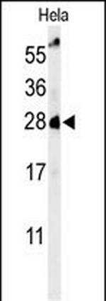 RAB8A Antibody in Western Blot (WB)