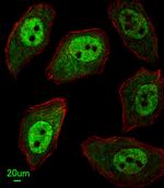 APEX2 Antibody in Immunocytochemistry (ICC/IF)