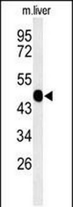 WASP Antibody in Western Blot (WB)