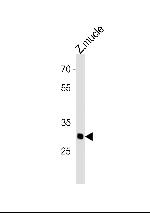 HMX3 Antibody in Western Blot (WB)