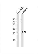 HOXC9A Antibody in Western Blot (WB)