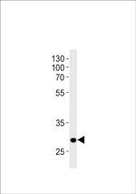 HOXC9A Antibody in Western Blot (WB)