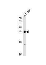 Neurogenin 1 Antibody in Western Blot (WB)