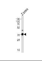 GNB1 Antibody in Western Blot (WB)