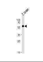 FOXH1 Antibody in Western Blot (WB)