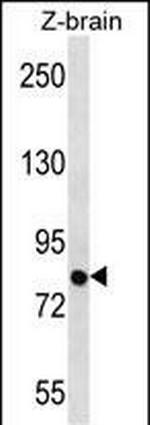 SIM1 Antibody in Western Blot (WB)