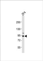 RRM1 Antibody in Western Blot (WB)