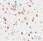 CHD7 Antibody in Immunohistochemistry (Paraffin) (IHC (P))