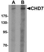 CHD7 Antibody in Western Blot (WB)