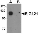 KIAA1324 Antibody in Western Blot (WB)