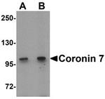 Coronin 7 Antibody in Western Blot (WB)