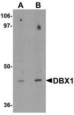 DBX1 Antibody in Western Blot (WB)