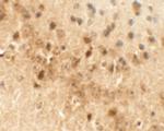 Draxin Antibody in Immunohistochemistry (Paraffin) (IHC (P))