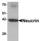 Draxin Antibody in Western Blot (WB)