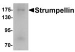 KIAA0196 Antibody in Western Blot (WB)