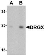 DRGX Antibody in Western Blot (WB)